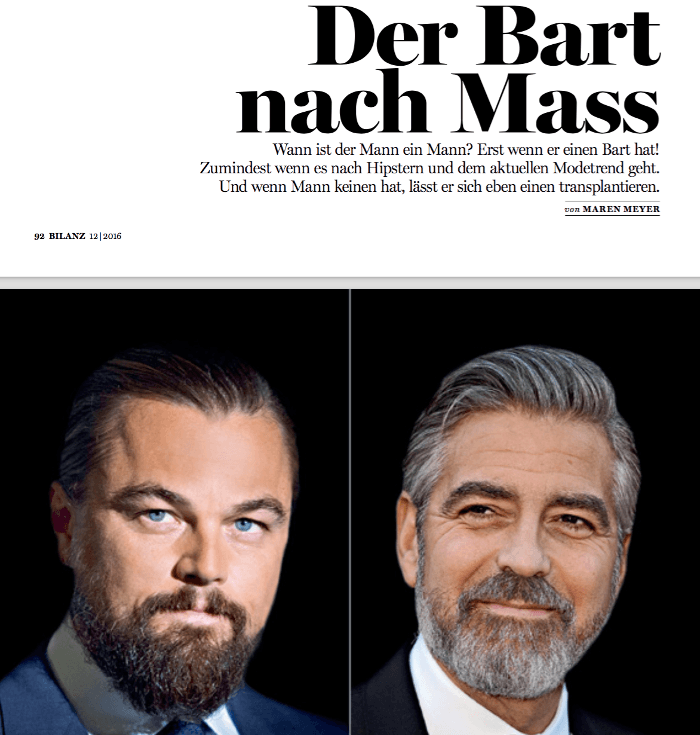 Haartransplantation vom Bart - Hairforlife Andreas Krämer im Wirtschaftsmagazin Bilanz