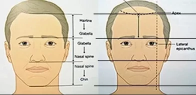 Haarlinien Haartransplantation Da-Vinci Konzept goldener Schnitt - Hairforlife-Haartransplantation.com