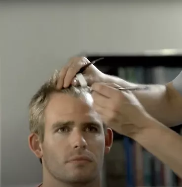 Haartransplantation.de – neutrale Beratung bei Haarausfall