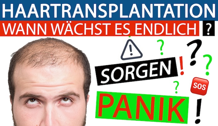 Haartransplantation Panik und Sorge: Wann wachsen die Haare/Transplantate/Grafts endlich?