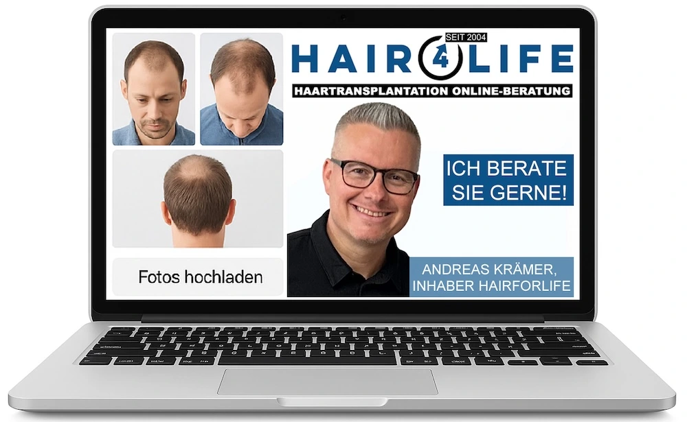 Online-Beratung zur Haartransplantation – Fotos hochladen, diskret, unverbindlich und online