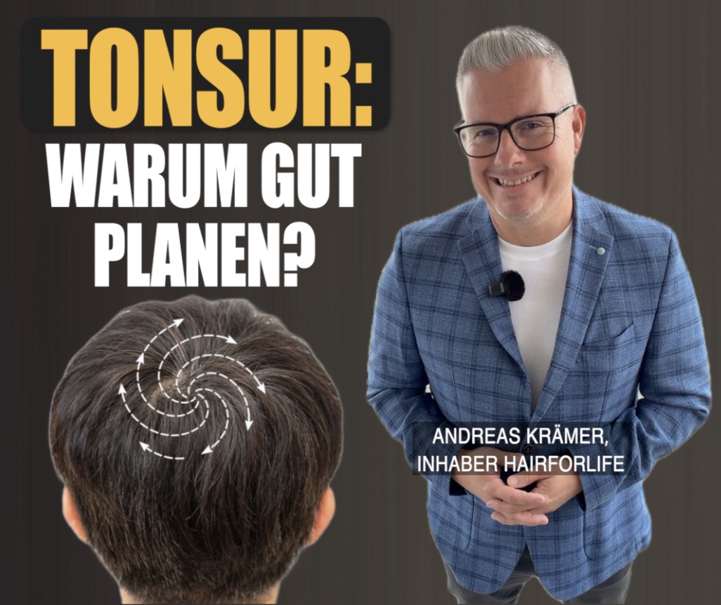 Haartransplantation Tonsur Mönchsglatze und langfristige Planung