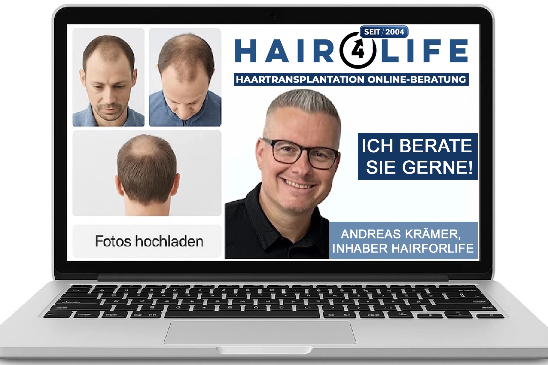 Online-Beratung zur Haartransplantation – Fotos hochladen, diskret, unverbindlich und online