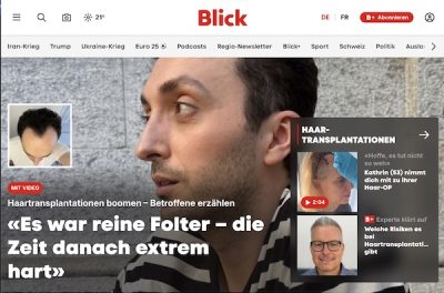 Andreas Krämer Interview über Haartransplantation – Blick.ch Zeitung – Print und Online Andreas Krämer Interview über Haartransplantation - Blick.ch Zeitung - Print und Online